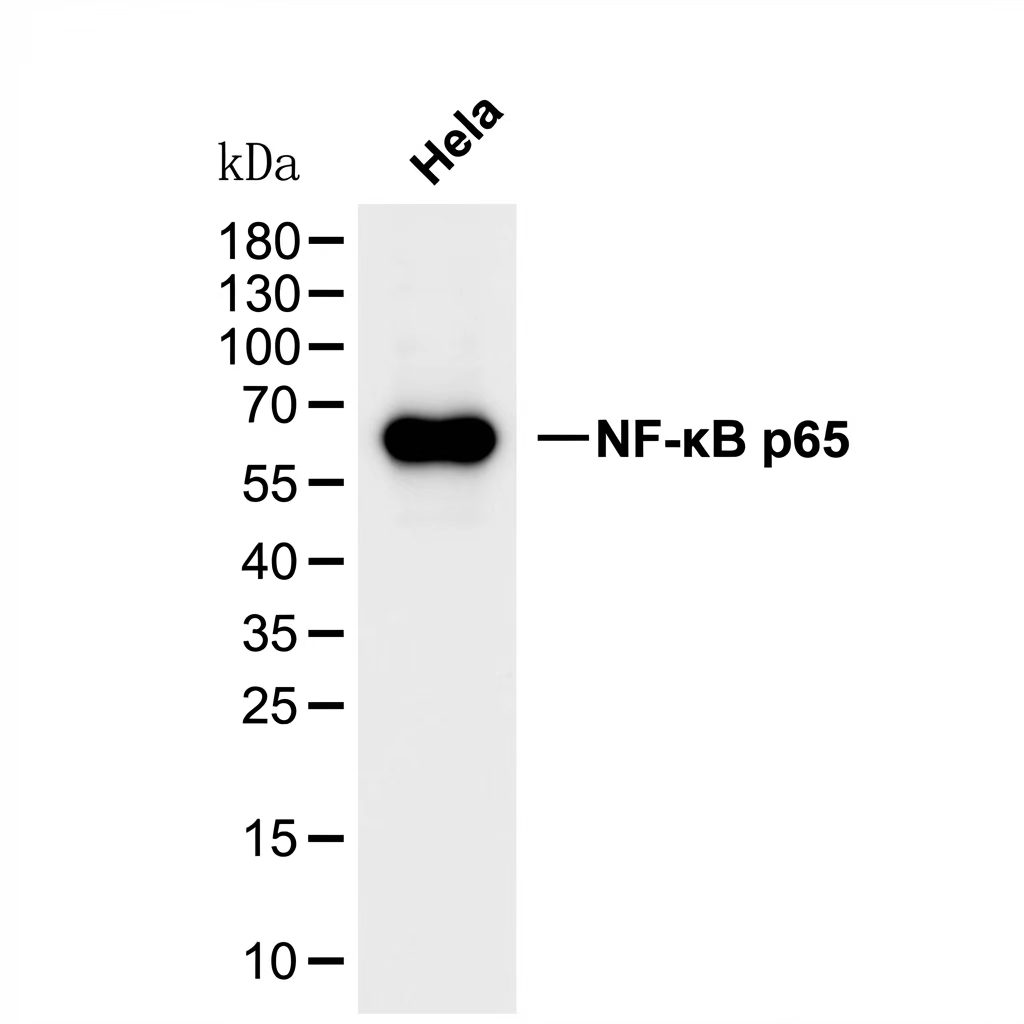 NF-&kappa;B p65 (R197I) Rabbit mAb